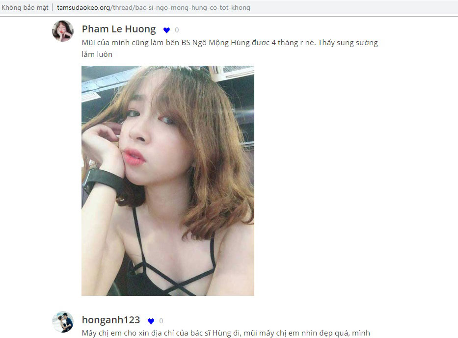 Kẹp nâng mũi facebook mua ở đâu?