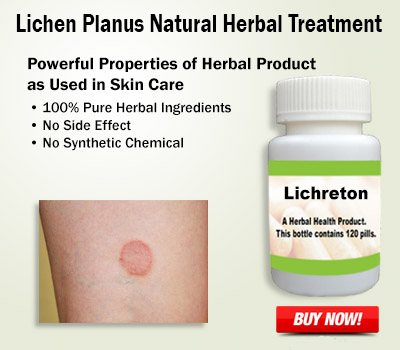 Lichen Planus Causes, Symptoms, Diagnosis and Herbal Treatment