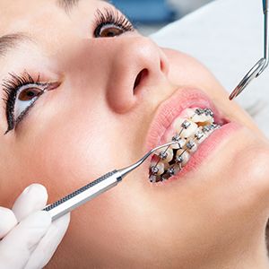 How Do You Find A Good Dentist For Braces Treatment?
