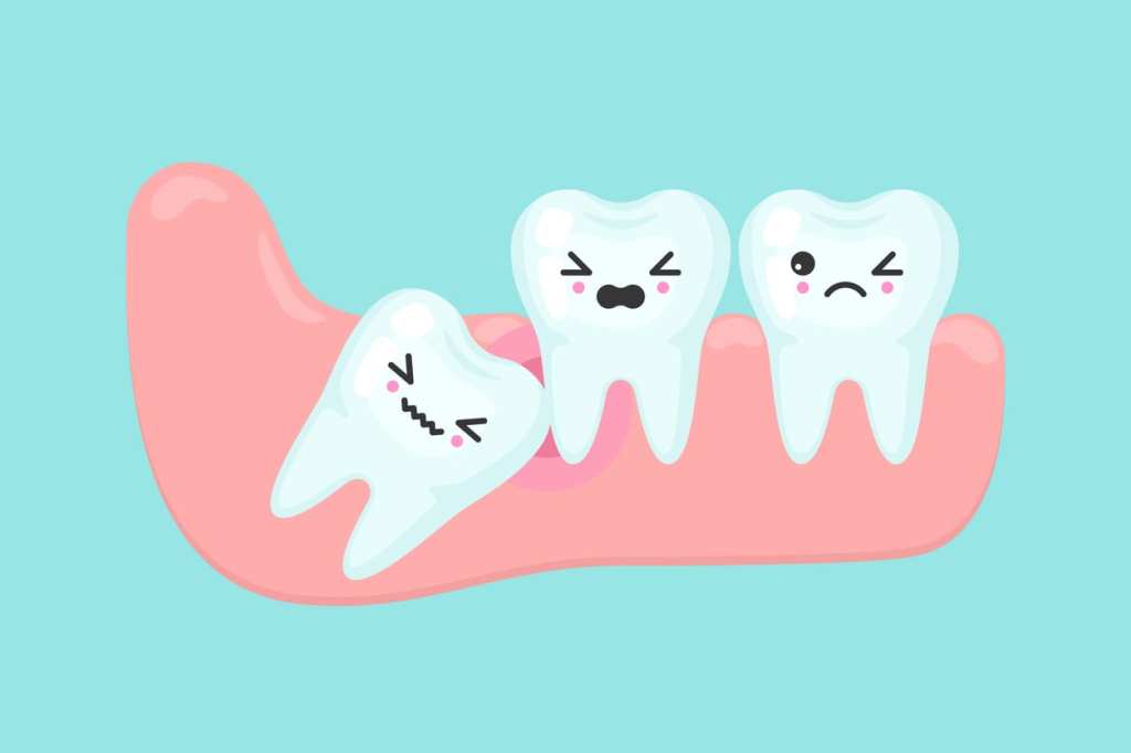 Teeth Can Be Extracted Without Feeling Pain