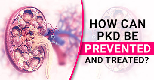 How Can PKD Be Prevented And Treated?