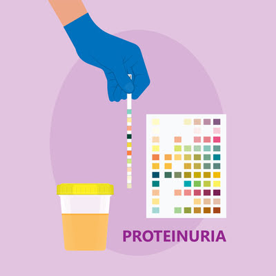 Protein loss in urine treatment in Ayurveda is  effective