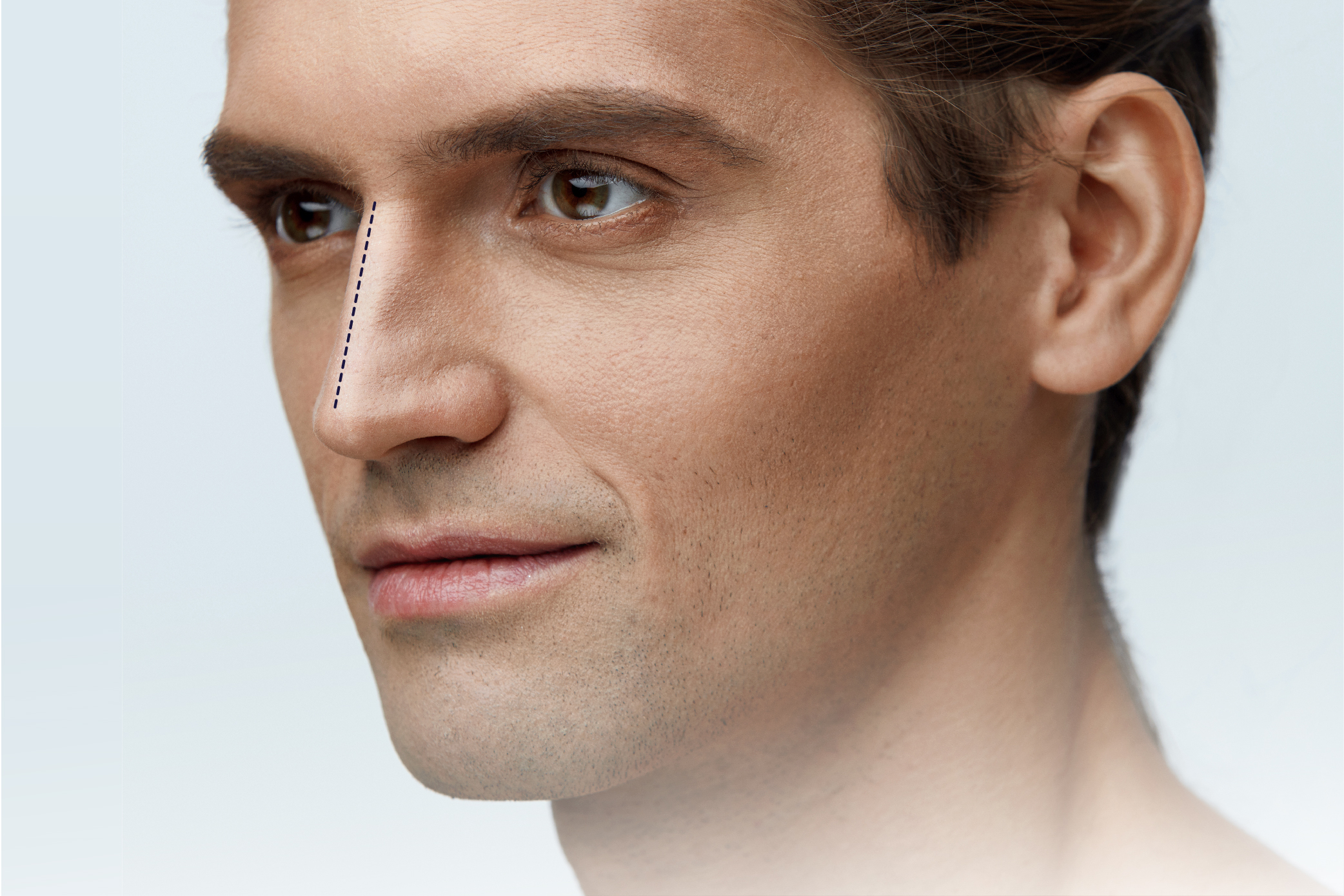 Nose Reshaping Dubai - Rhinoplasty Dubai- Nose Job In Dubai
