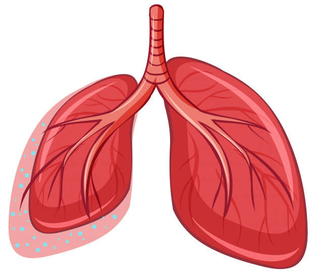 Lung Cancer Surgery Market Report Offering Market Outlook, Industry Size, Market Share, Forecast