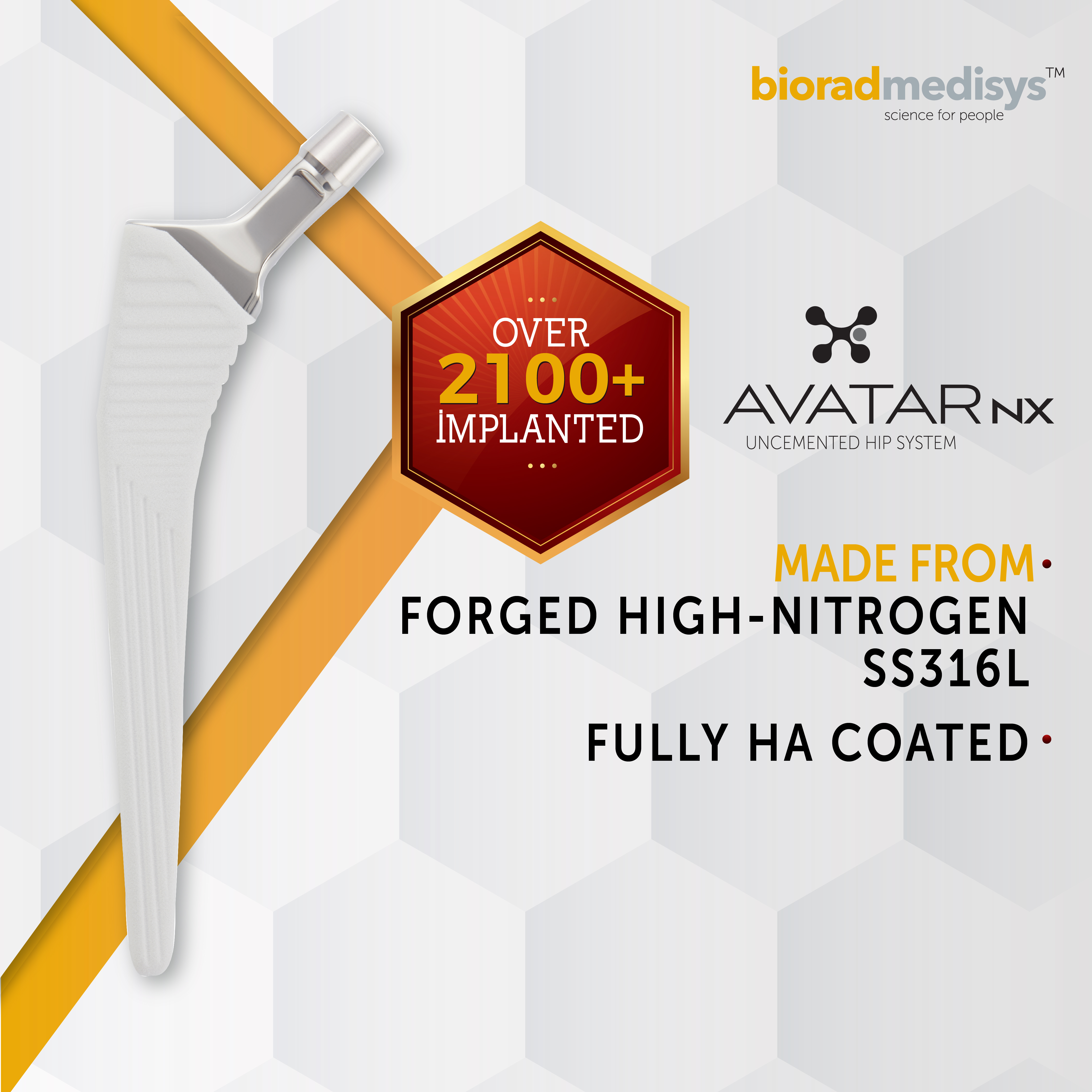 Avatar NX Bipolar Hip System