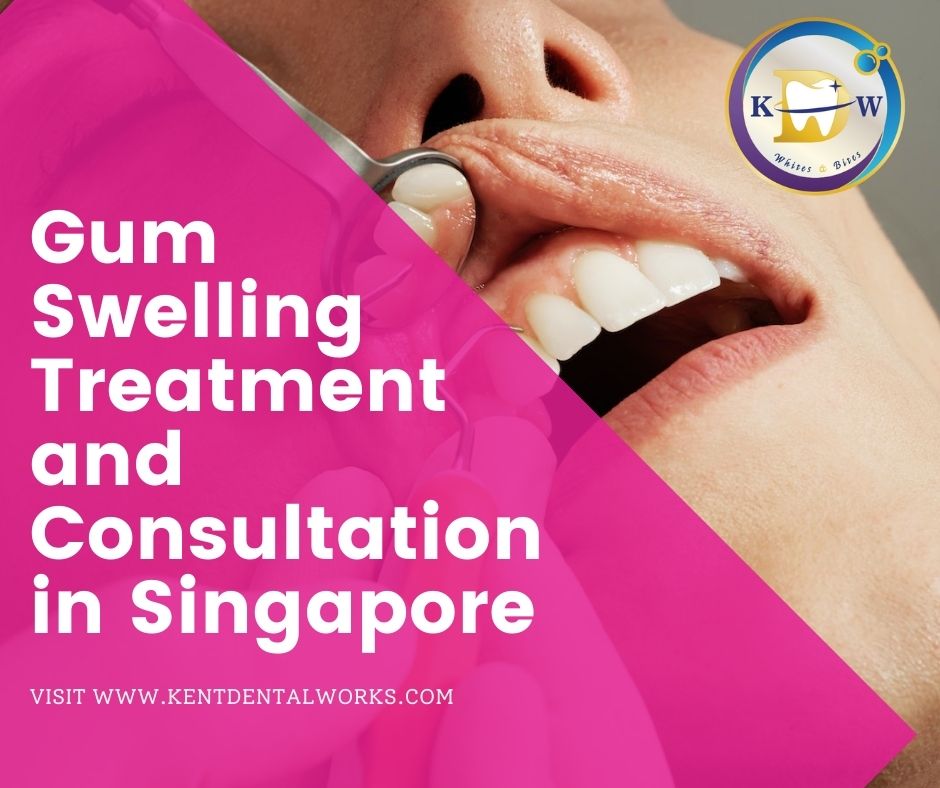 Gum Swelling - Meet your Dentist in Singapore