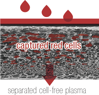 Global Plasma Separation Membrane Market Research Report 2021
