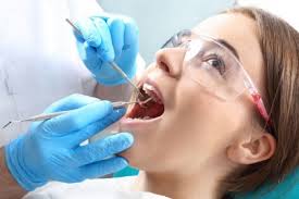 Porcelain Veneer: Advantages and Lifespan