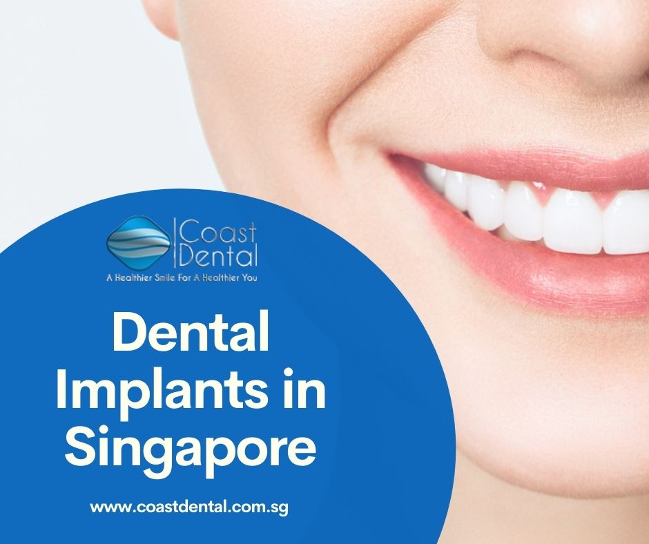 Dental Implant in Singapore
