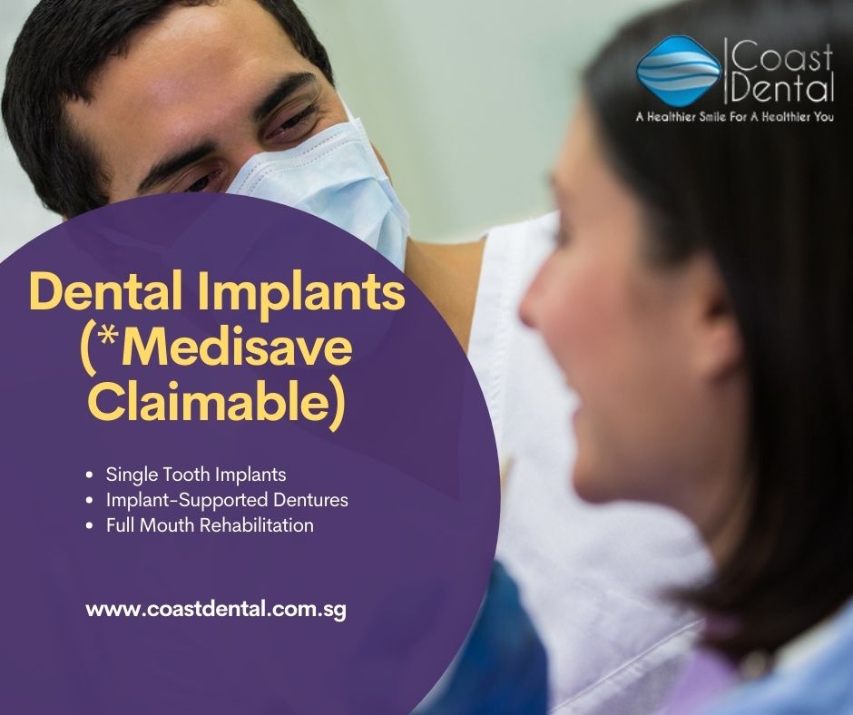Tooth Implant in Singapore