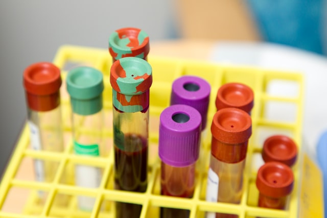 Blood Screening Market is Expected to Witness Sustainable Growth During the Forecast Period (2021-2026)