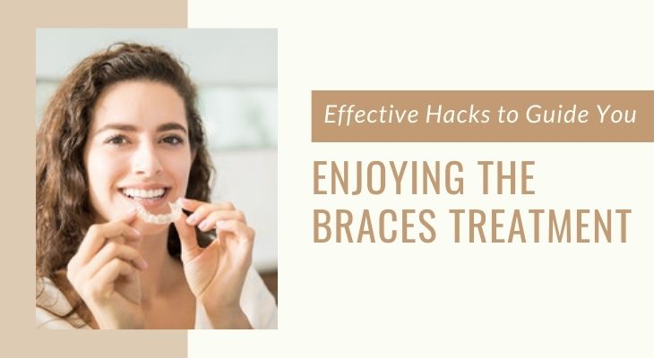 Effective Ways To Enjoying the Braces Treatment