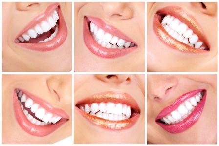 Tips For Avoiding: Dislodged, Broken, Cracked Teeth
