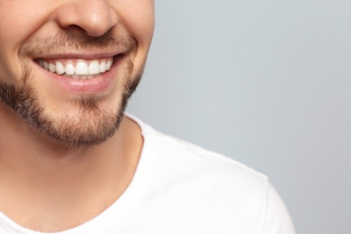 What Exactly Are The Best Tooth Whitening Kits?