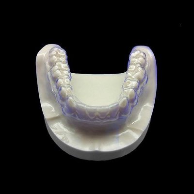What is the Need to Choose Invisible Teeth Aligners