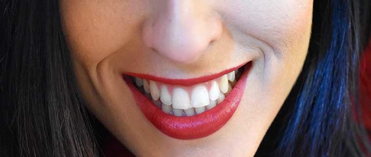 Braces or Invisalign – Which is Better?