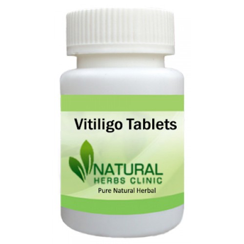 Herbal Treatment for Vitiligo - Natural Herbs Clinic
