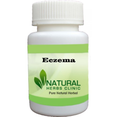 Herbal Treatment for Eczema | Natural Remedies | Natural Herbs Clinic
