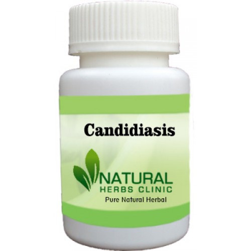 Herbal Treatment for Candidiasis
