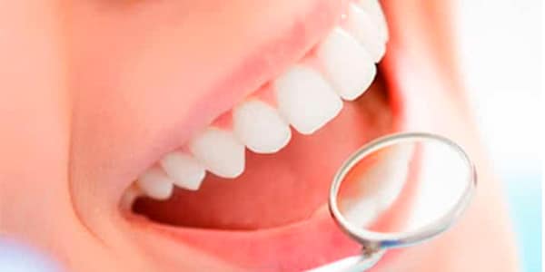 Best Dentist for Veneers in Dubai
