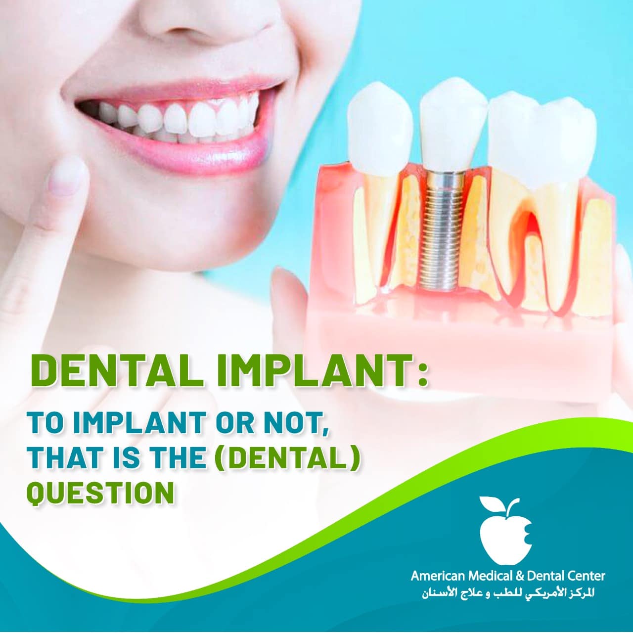 Dental Implants in Dubai