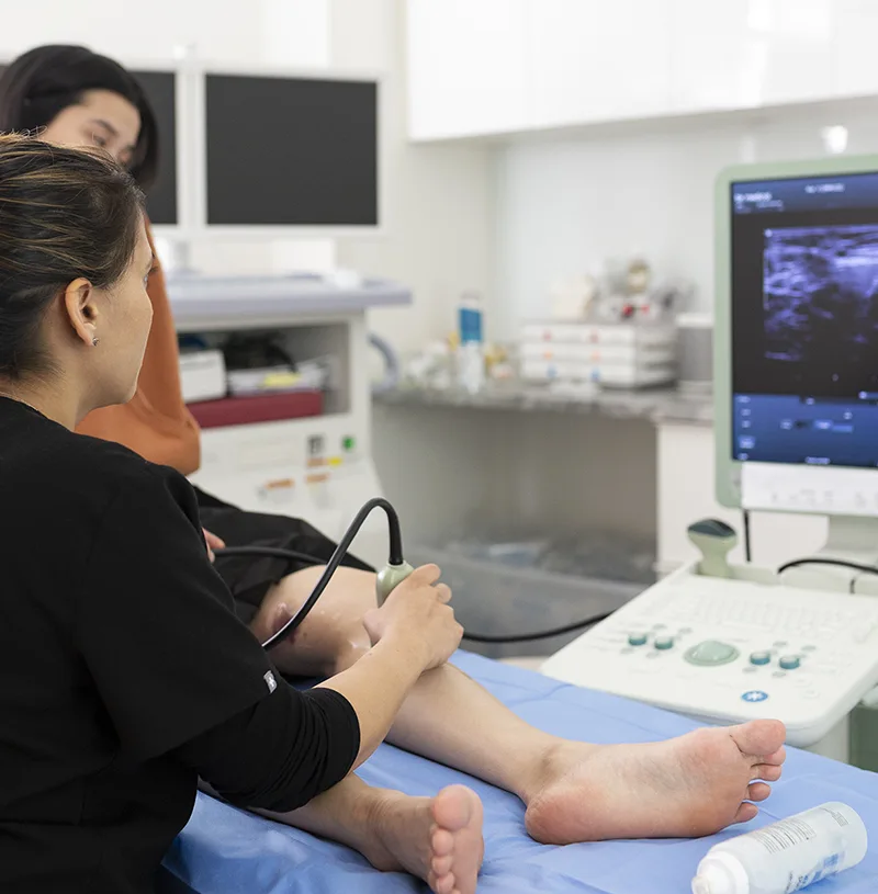 What Is The Most Effective Vein Treatment?