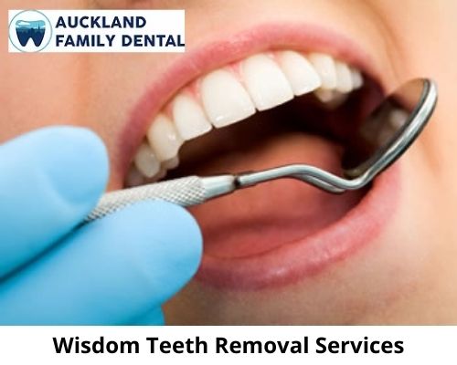 Wisdom teeth Auckland