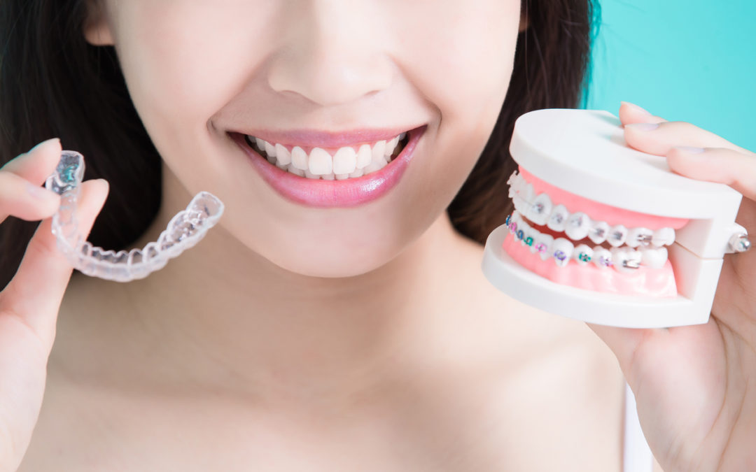 Orthodontics Auckland