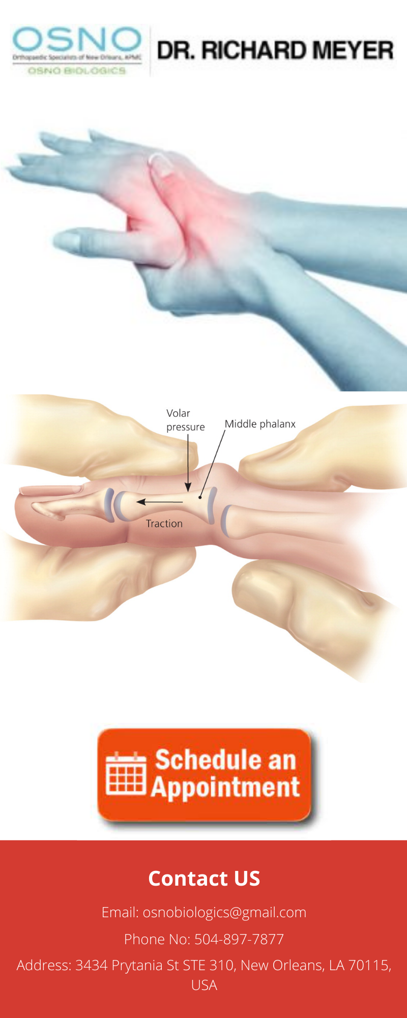 Finger Injuries Treatment Specialist