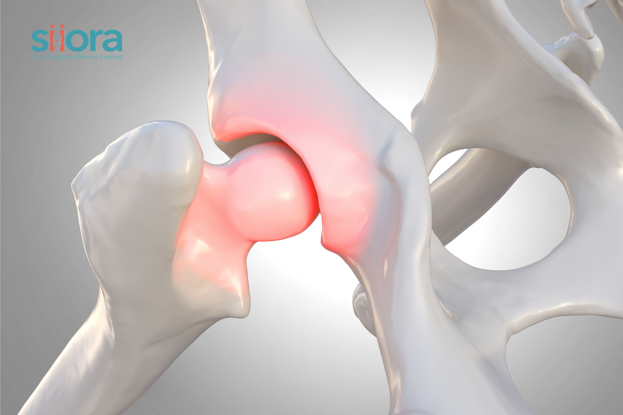 Optimal Recovery from Hip Fractures