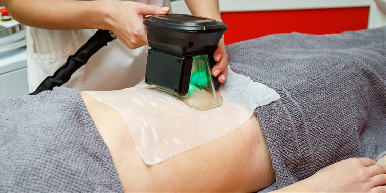 Coolsculpting San Diego