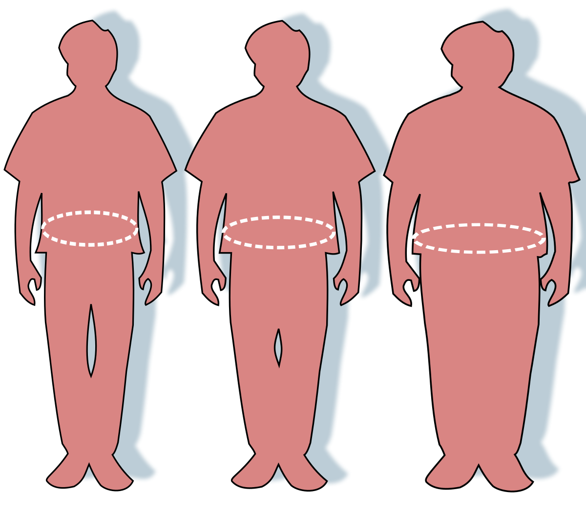 Decoding Obesity | Strategies To Prevent Obesity