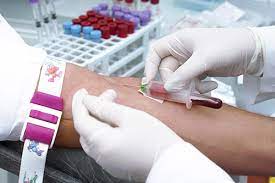 Companion Diagnostics Market | Global Industry Trends, Segmentation, Business Opportunities & Forecast To 2027