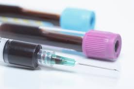 Report on Prothrombin Complex Concentrate Market Research 2027 - Value Market Research