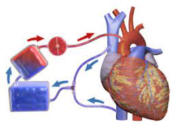 Artificial Heart-Lung Machine Market Size, Share, Growth, Opportunities and Global Forecast to 2027