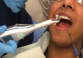 Report on Dental Caries Detectors Market Research 2027 - Value Market Research
