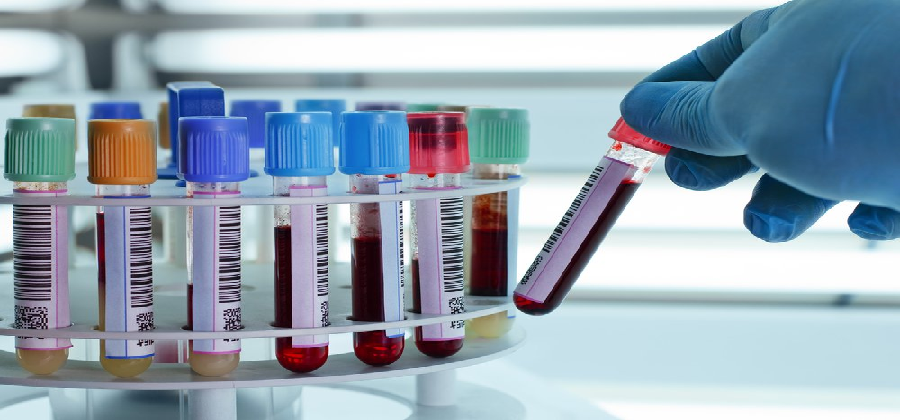 Factors you must consider before visiting a path lab