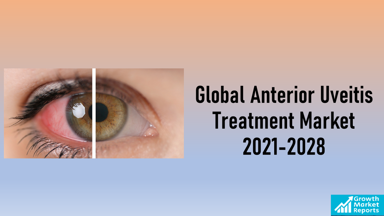 Global Anterior Uveitis Treatment Market Size & Share Report 2021-2028 | Growth Market Reports