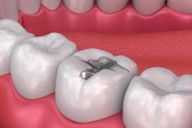 Global Mercury Poisoning Treatment Market Report, Latest Trends, Industry Opportunity & Forecast to 2027