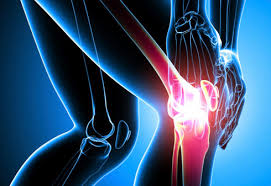 Orthopedic Joint Replacement Market 2020 Size, Dynamics & Forecast Report to 2027