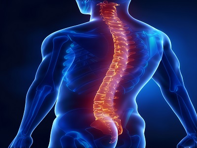 Scoliosis and Chiropractic : Stay Ahead of the Curve