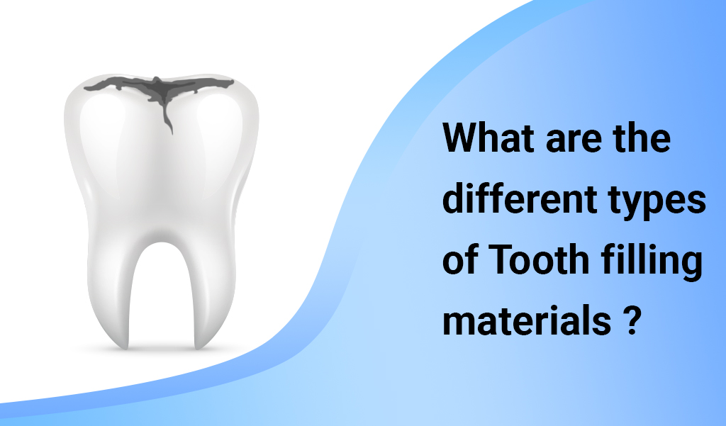 What are the different types of tooth filling material?