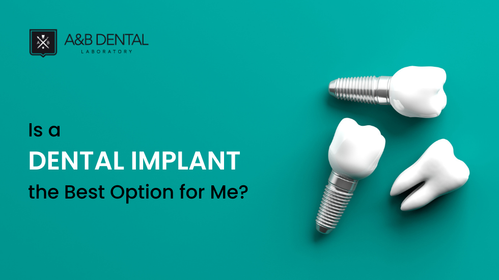 Is a Dental Implant the Best Option for Me?