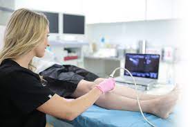 Questions to Ask Before Your Vein Treatment