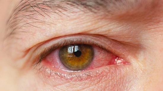 Asia-Pacific Dry Eye Syndrome Treatment Market Size, Industry Trends, Leading Players, SWOT Study, Share and Forecast to 2026