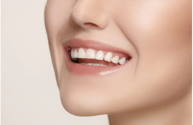 Best Teeth Whitening Treatment in Mississauga
