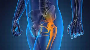 Metastatic Osteosarcoma Treatment involves removing metastases with surgery followed by chemotherapy