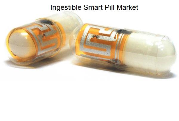 With gastrointestinal monitoring endoscopy, ingestible smart pills offer superior results