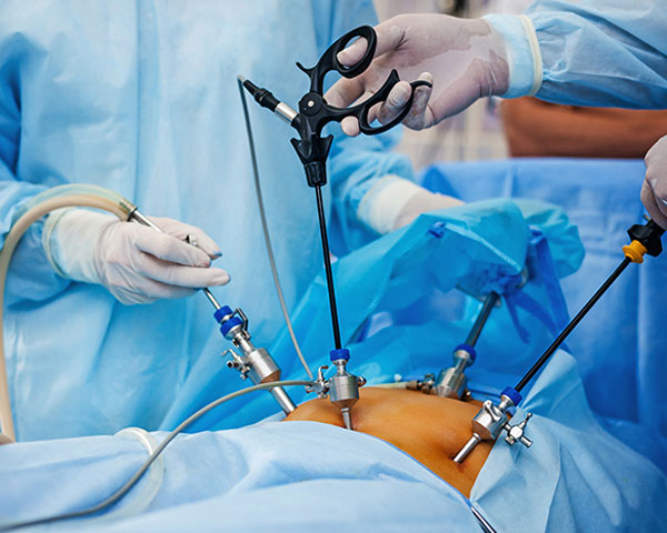 Kgj hospitals is the best hospital for laparoscopy surgery