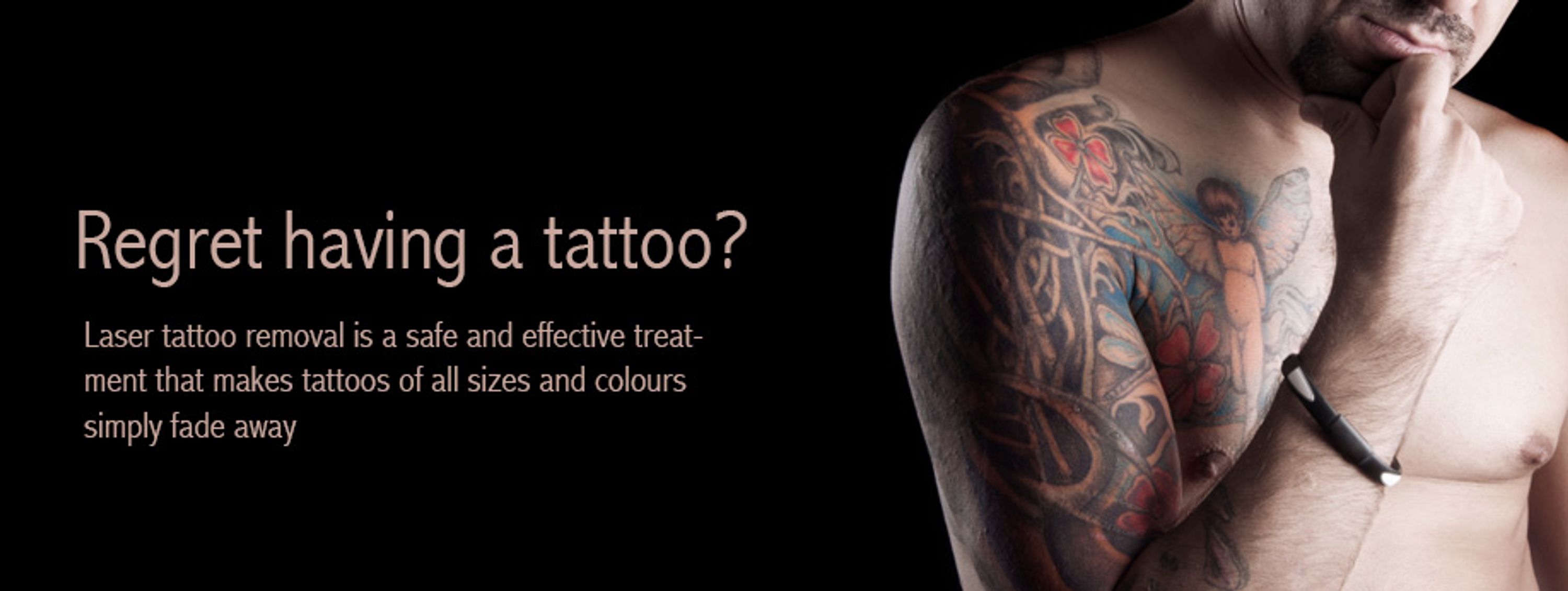 Laser Tattoo Removal Services